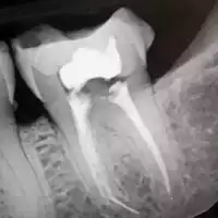 Room for rent in Crown Heights - Brooklyn, New York