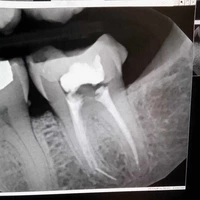 Cuarto en Renta en Crown Heights - Brooklyn, New York